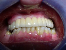 Dentist in Lincoln Park, IL